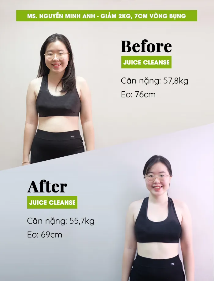 Nguyễn Minh Anh - Trước - Sau (Chính diện) · Giảm 2kg & 7cm vòng bụng